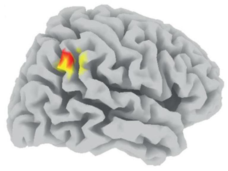 The right TPJ finding is depicted. Slow waves in the right TPJ during deep sleep correlate with prosocial preferences.