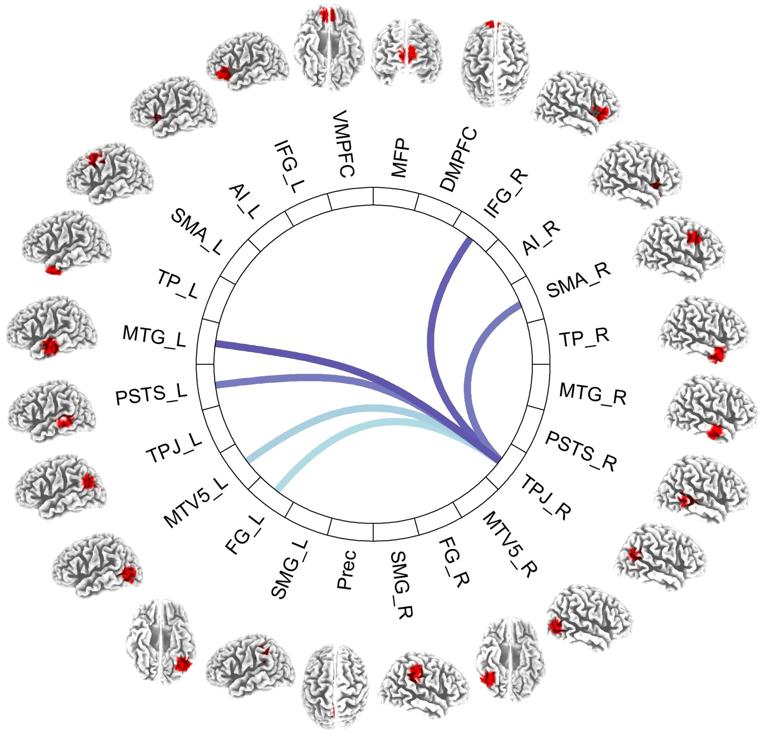 This is a functional connectivity map showing the connections between the right temporal-parietal junction (TPJ) and other regions of the human cortex associated with prosociality.