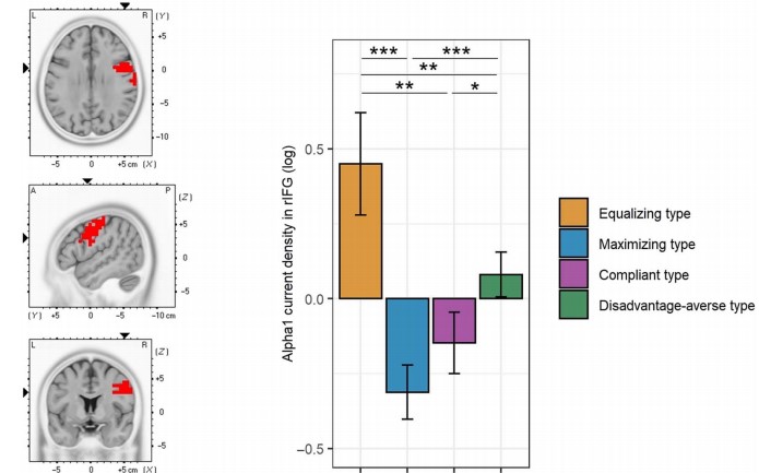Three brains and a bar graph show results from the EEG study on Distributional Preferences.