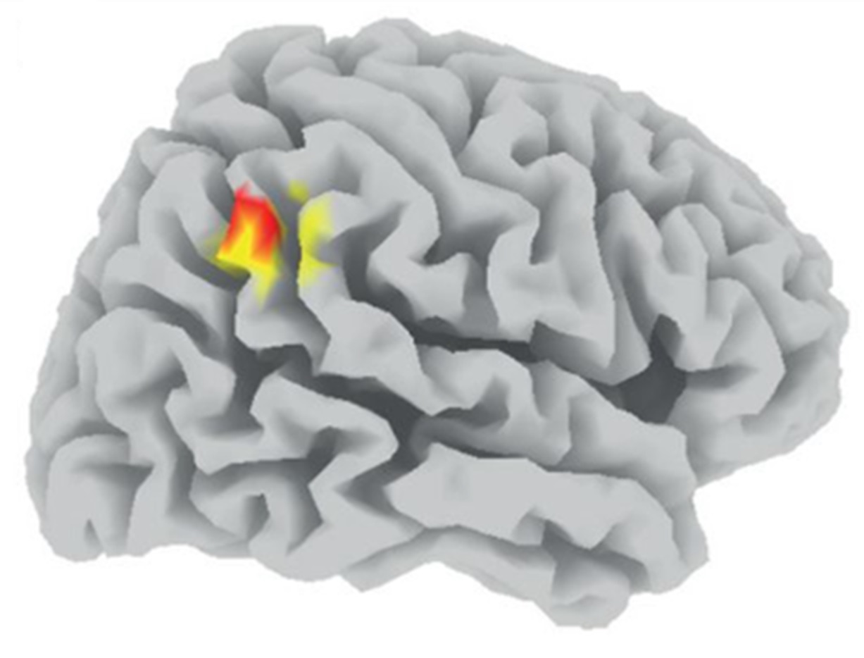 The right TPJ finding is depicted. Slow waves in the right TPJ during deep sleep correlate with prosocial preferences.