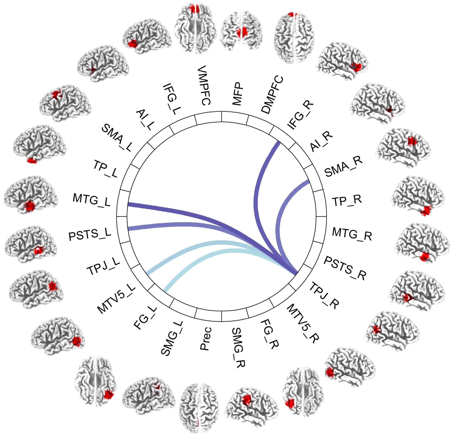 This is a functional connectivity map showing the connections between the right temporal-parietal junction (TPJ) and other regions of the human cortex associated with prosociality.